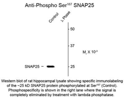 Western Blot: SNAP25 [p Ser187] Antibody [NBP2-29522]